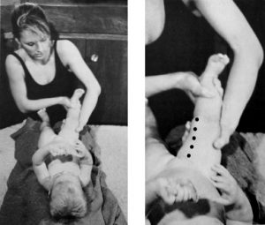 Baby Myotherapy - trigger points