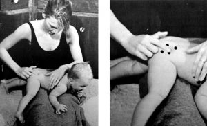 Baby Myotherapy - trigger points