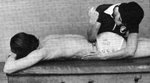 Myotherapy, Trigger Points, and Sciatica